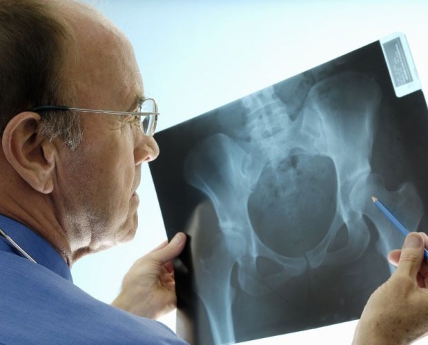 остеопороз на рентгене
